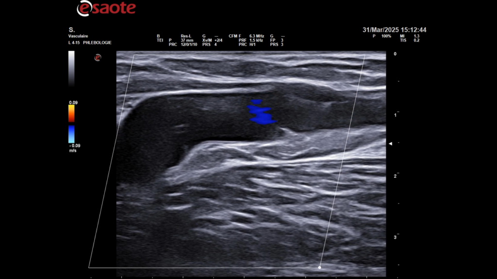 Capture D'écran 2025 04 03 154545
